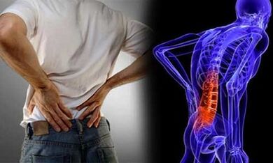 Lumbar osteОchondrosz дамыту себептері